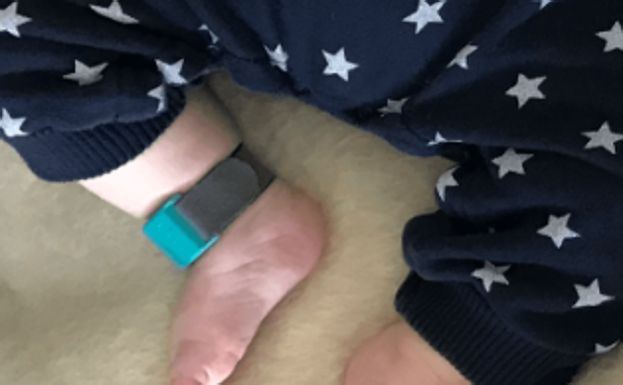 En bebés se puede colocar la pulsera en el tobillo./Liip