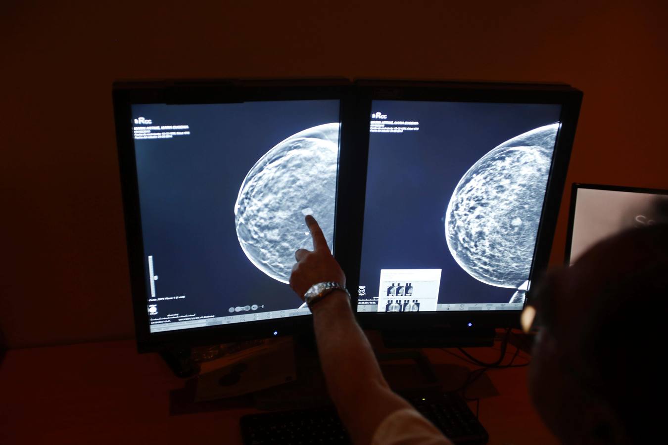 El Álvarez Buylla, puntero en radiología