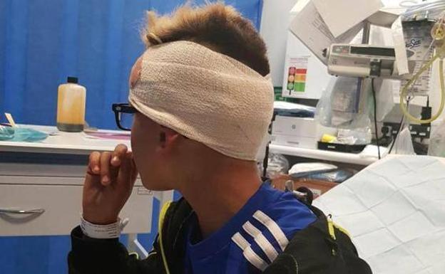 Un grupo de menores clavan un trozo de madera en la cabeza a un niño con autismo