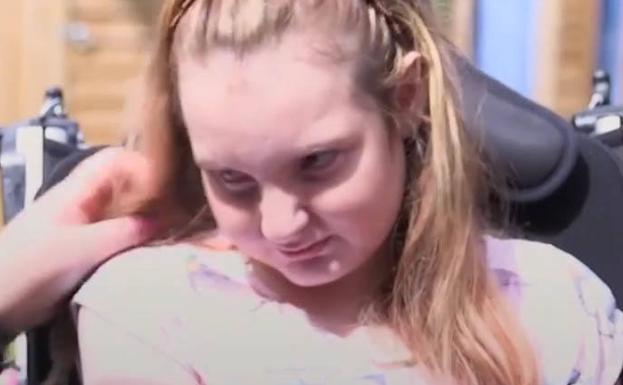 La trágica historia de dos hermanas que son las personas más jóvenes con demencia