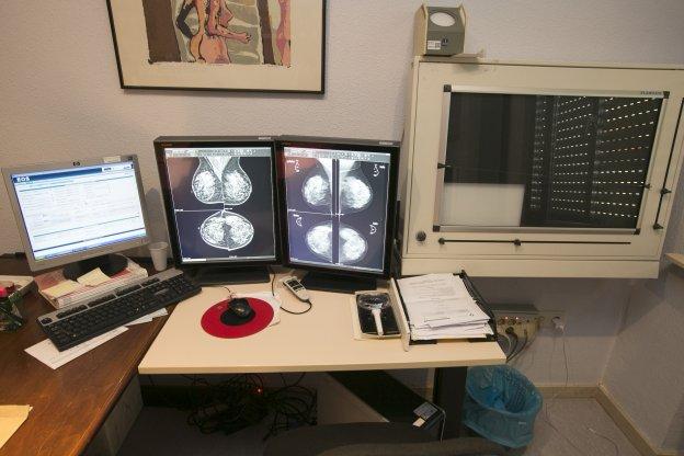 Sanidad compra un mamógrafo para el San Agustín ante las constantes averías del anterior