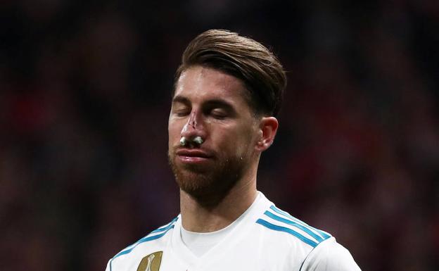 Sergio Ramos, con la nariz rota tras una patada de Lucas