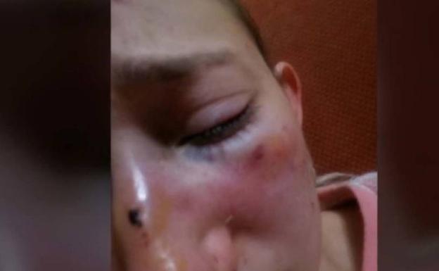 «Tengo miedo a salir a la calle»