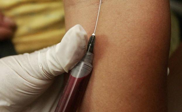 El sida repunta con 82 nuevos casos en Asturias, la cifra más alta desde 2012