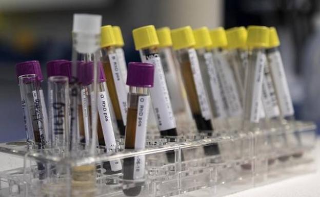 Un simple análisis de sangre permitirá detectar el alzhéimer 16 años antes de los primeros síntomas