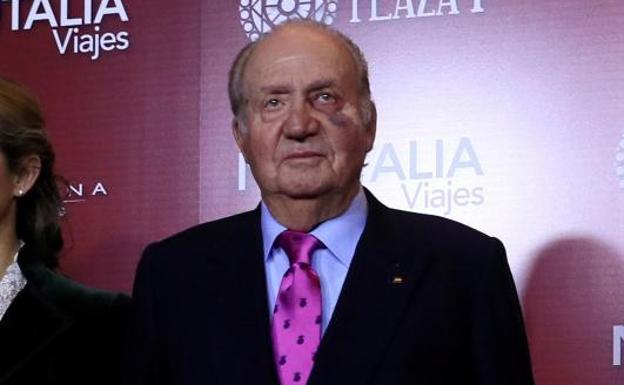 El Rey Juan Carlos reaparece en público con un moratón en el ojo