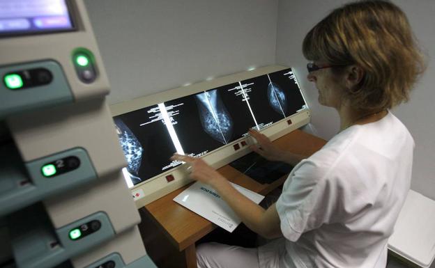 Asturias actualiza el programa de cáncer de mama para reducir su mortalidad