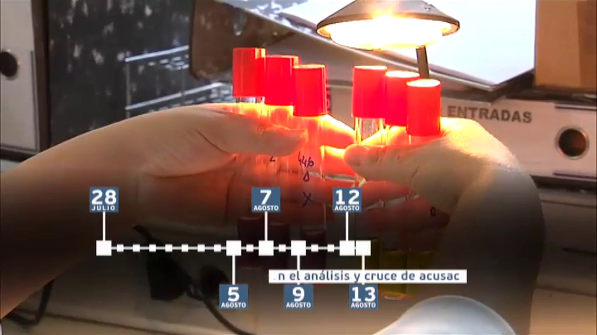 Salud investiga siete nuevos casos de listeria en Asturias