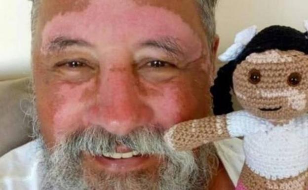 Teje una muñeca con manchas en la piel para hacer feliz a su nieta