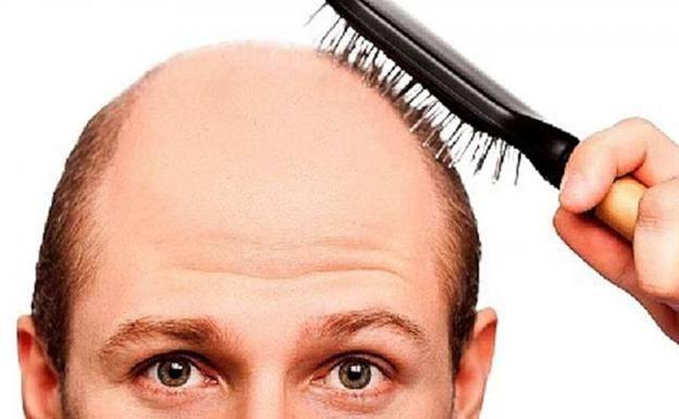 La contaminación del aire favorece la calvicie