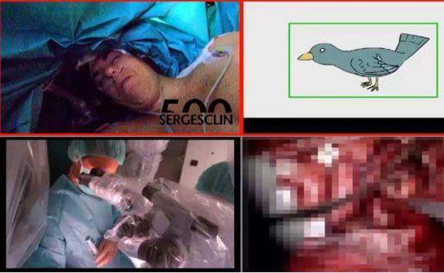 «Abre los ojos, vamos a operarte el cerebro»