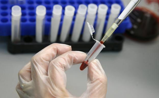 Asturias detectó 54 nuevos casos de VIH en 2018