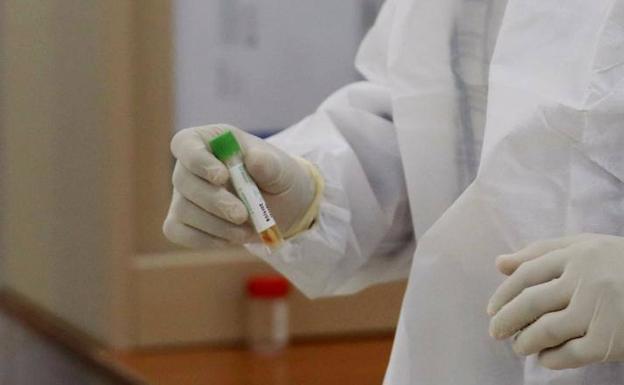 Coronavirus | Casi la mitad de los casos positivos leves no quedan inmunizados