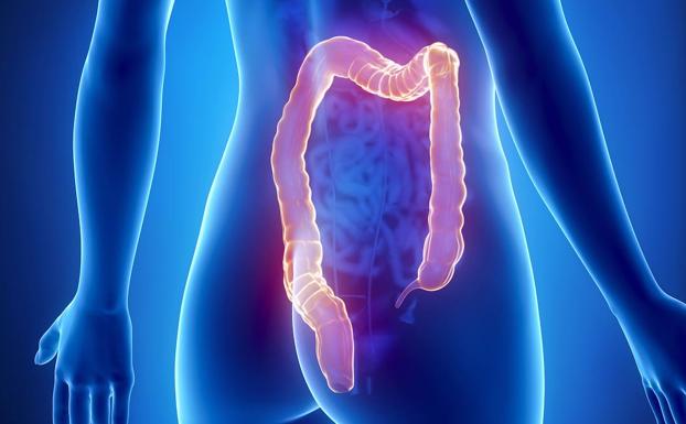 La dieta que reduce a la mitad el riesgo de cáncer de colon