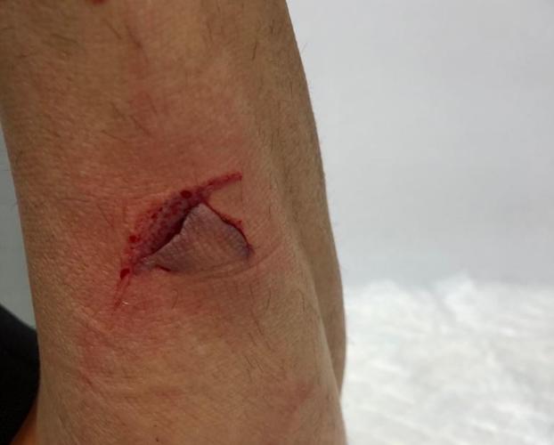 Hiere a cuatro policías tras amenazar a su madre con un cuchillo