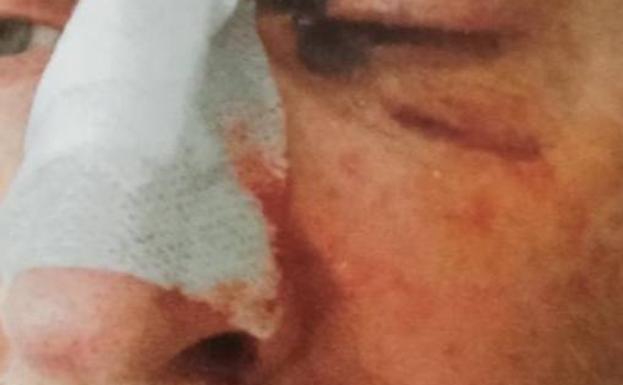 Denuncian una agresión a un funcionario de la prisión de Asturias que tuvo que salir en ambulancia