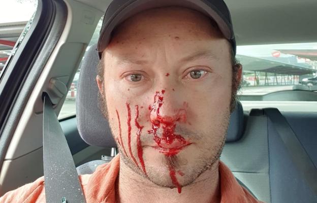 Agreden a un conductor en Gijón que recriminó acciones temerarias