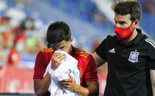 El golpe recibido deja a Manu fuera de los entrenamientos con la Selección