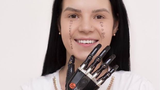 «Mi marido me cortó las manos»