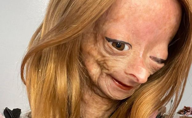 La 'youtuber' con el síndrome de 'Benjamin Button' fallece a los quince años