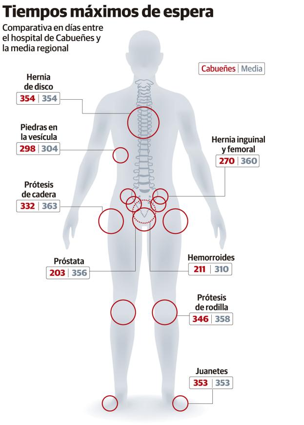 Hasta un año de espera para operarse de juanetes o hernia de disco en Cabueñes