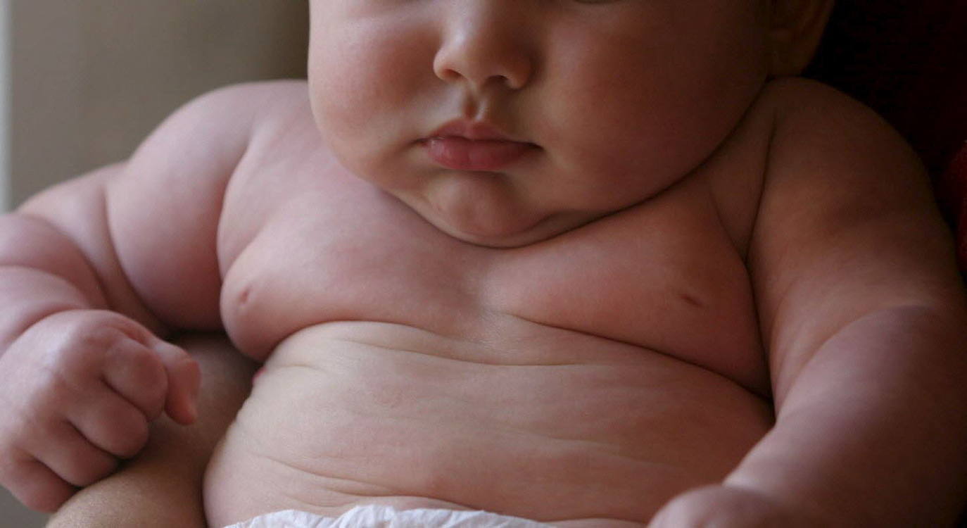 Trucos y alimentos para prevenir la obesidad infantil