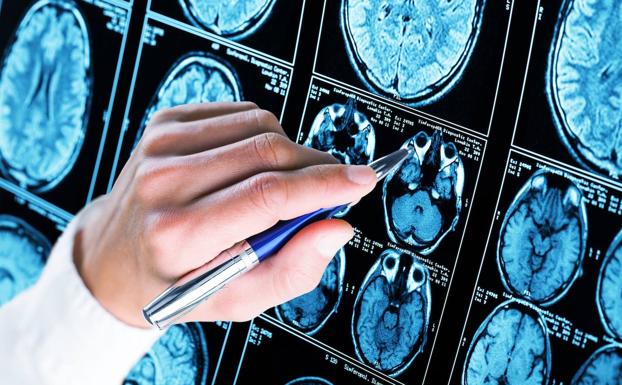 La relación entre el sueño y el Alzheimer: las largas siestas pueden ser una señal de demencia