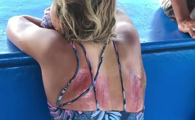 La surfista gijonesa Lucía Martiño sufre un accidente contra un arrecife de coral