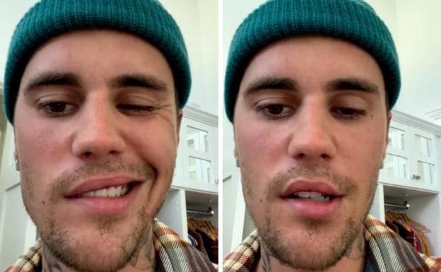 Una parálisis facial obliga a Justin Bieber a cancelar sus próximos conciertos | El Comercio