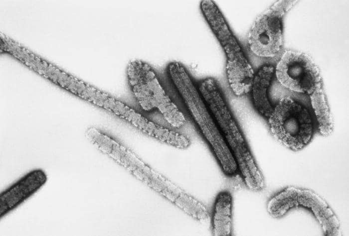 Alerta sanitaria en la OMS tras detectar varias muertes por un virus similar al Ébola