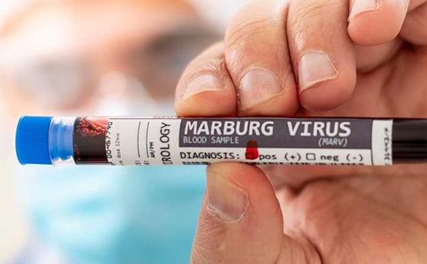 Qué es el virus de Marburgo: síntomas, cómo se contagia y tratamiento