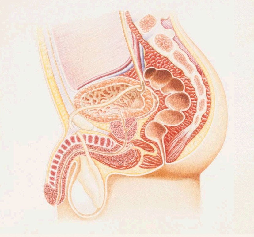 operacion de adenoma benigno de prostata