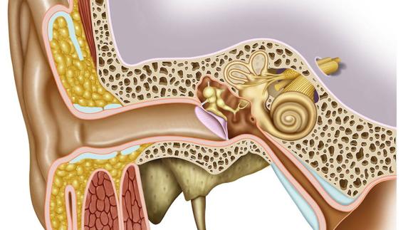 Una nueva técnica de imagen permite diagnosticar con máxima precisión la enfermedad de Ménière