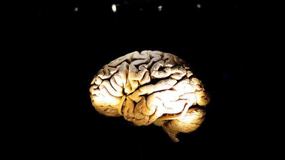 El cerebro es distinto en personas con déficit de atención