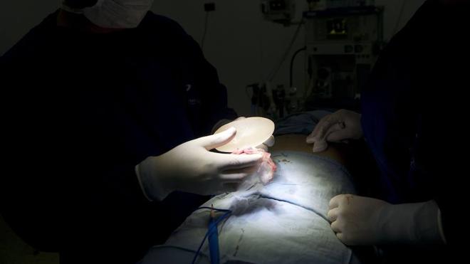 Siete de cada diez mujeres con cáncer de mama conservan el pecho tras la cirugía