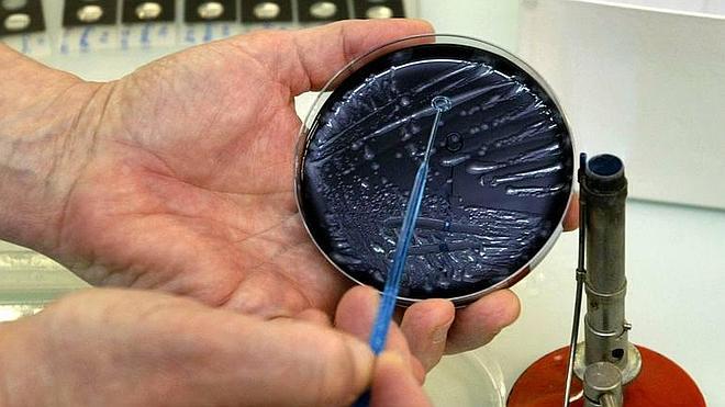 ¿Cómo se contrae la legionela?