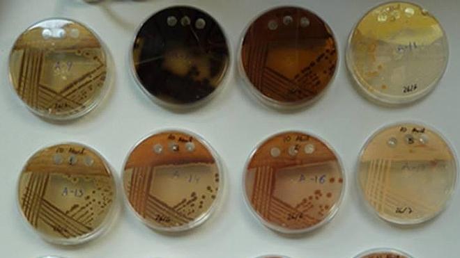 Lluvia de bacterias 'saludables'