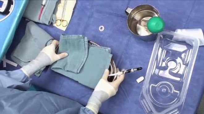 Así es la técnica para implantar un corazón artificial que se usó en el HUCA